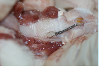大鼠正畸牙移动过程中压力侧牙周组织缺氧诱导因子-1α 的表达
